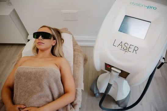 Laser Hair Removal Sessions
